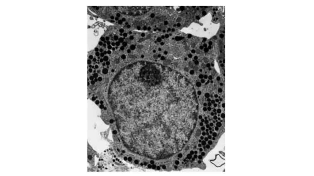 Electron Microscopy What is Electron Microscopy? - slide 6 of 12