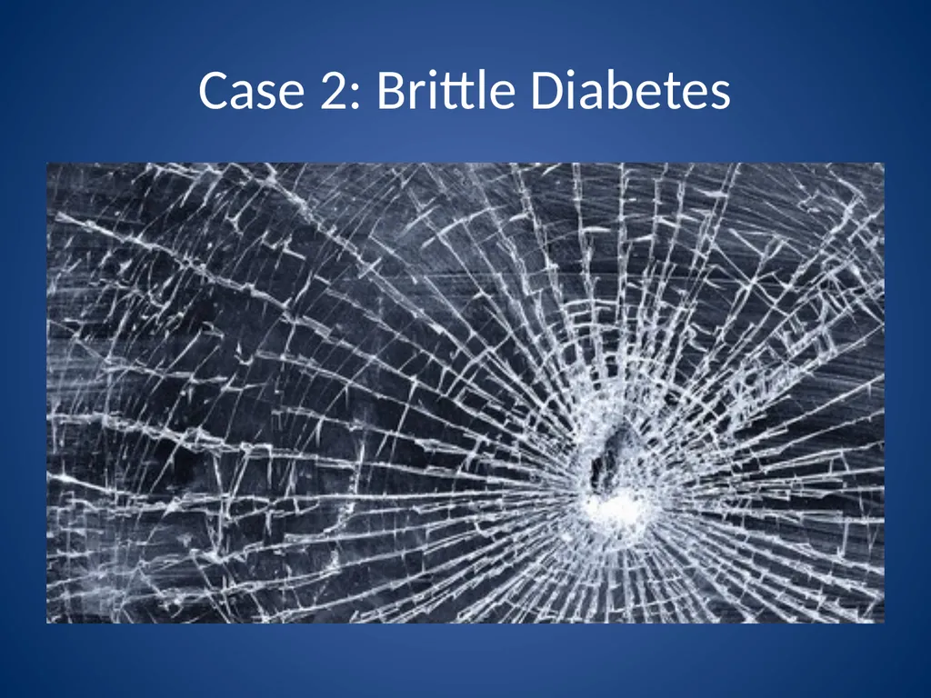 Difficult Cases in Diabetes Dr Sara Kazempour MD - slide 12 of 40