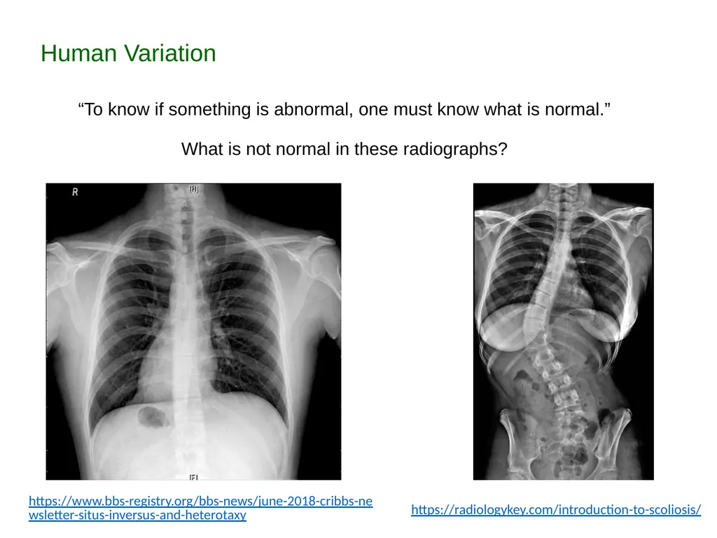 Description: This set of PowerPoint slides - slide 4 of 6