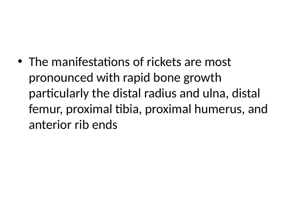 Rickets- radiology Dr jp,asst - slide 2 of 11