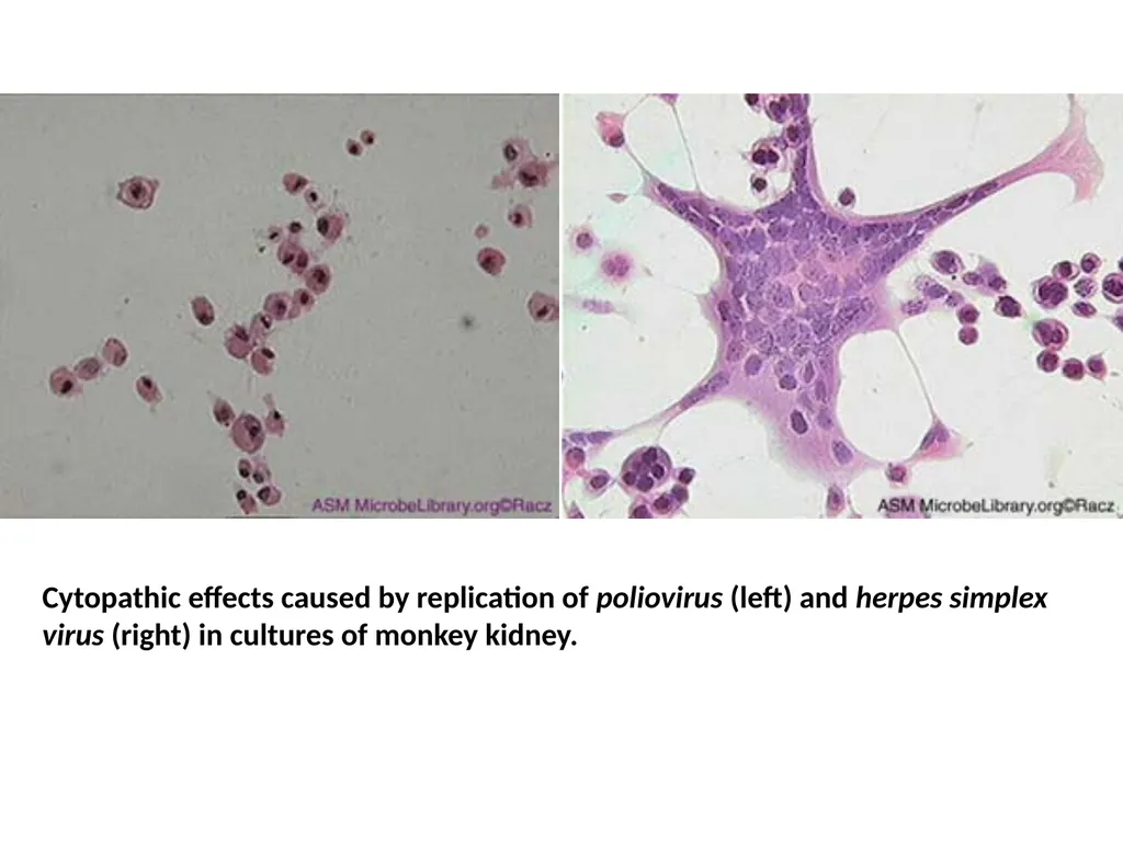 Lecture Three Methods in virology Methods used in - slide 14 of 15