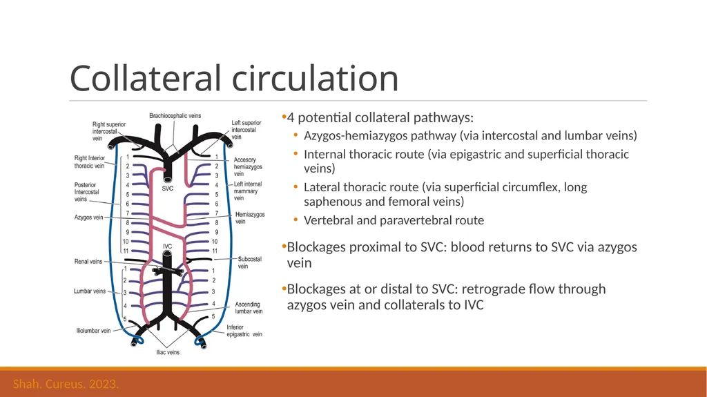 Superior Mediastinal Syndrome Saadiq Moolla 04 - slide 3 of 8