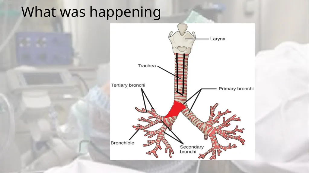 A Clot in the lung that will not come out - slide 6 of 13