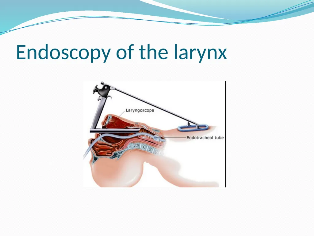 ENT Endoscopy Assis. Professor Dr Haider Alsarhan - slide 16 of 18