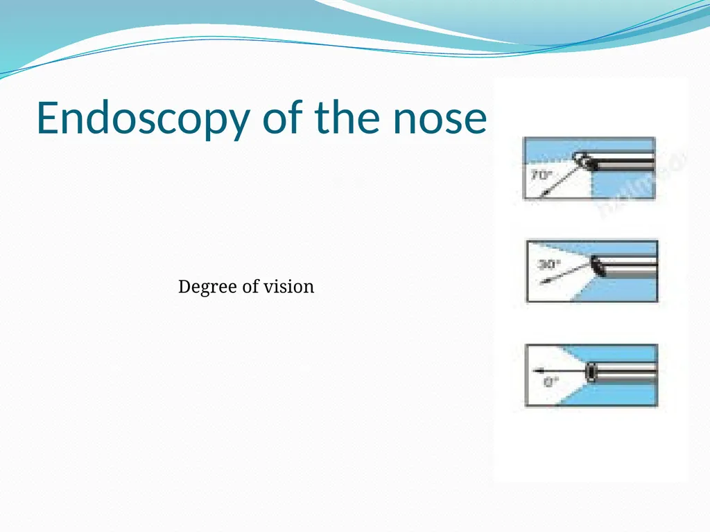 ENT Endoscopy Assis. Professor Dr Haider Alsarhan - slide 6 of 18