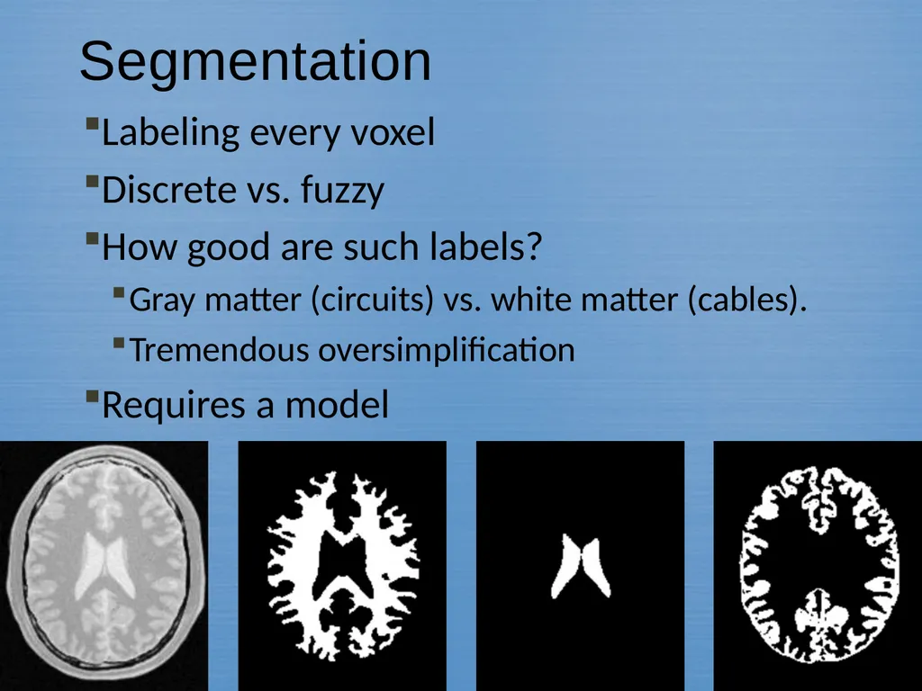 Methods In Medical Image Analysis Spring 2022 - slide 5 of 14