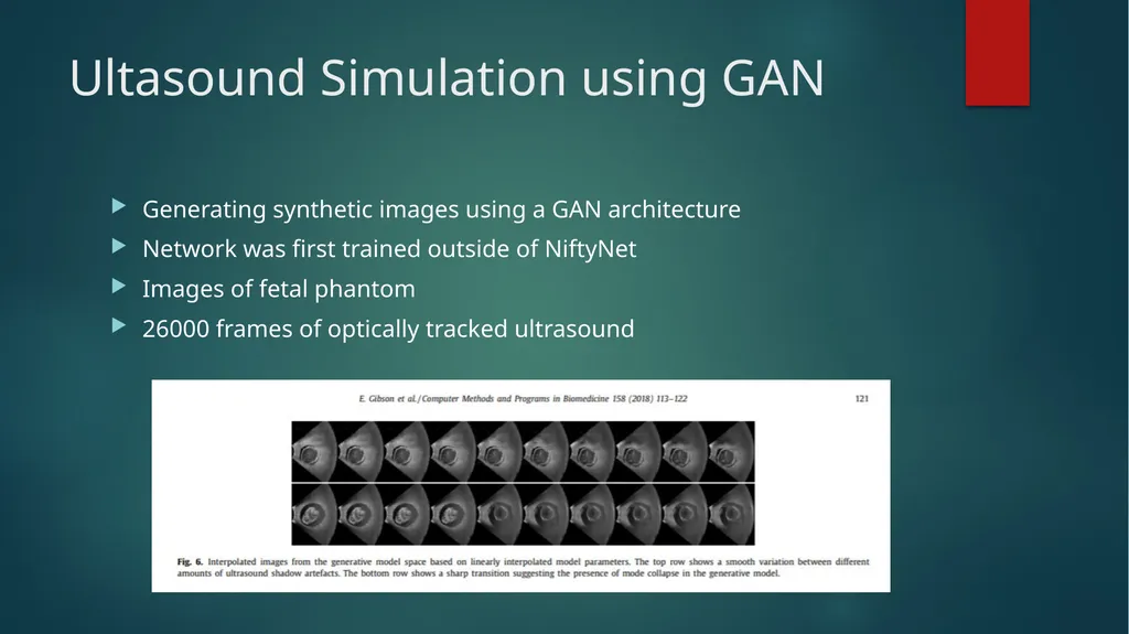 NiftyNet: A Deep learning platform for medical - slide 26 of 27