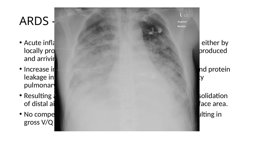 SpR 2; Intensive Care in the SCE Annette Fisher - slide 4 of 17