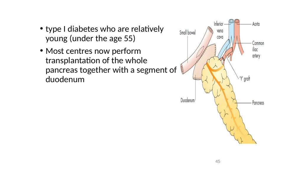 Transplantation surgery Dr. Ammar Fadil 1 History - slide 45 of 46