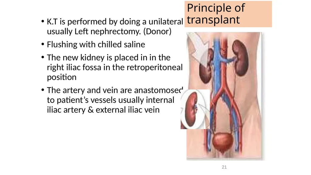Transplantation surgery Dr. Ammar Fadil 1 History - slide 21 of 46