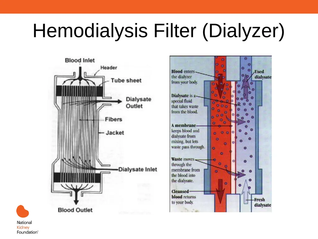 Renal Replacement Therapy: What the PCP Needs to - slide 22 of 64