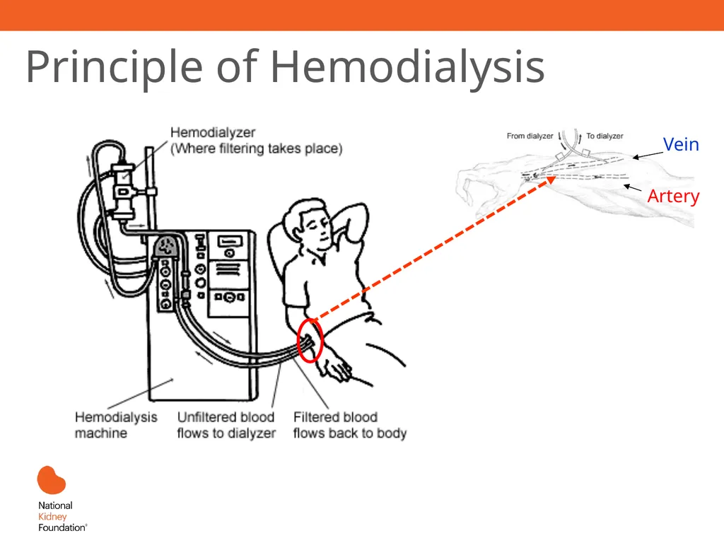 Renal Replacement Therapy: What the PCP Needs to - slide 19 of 64