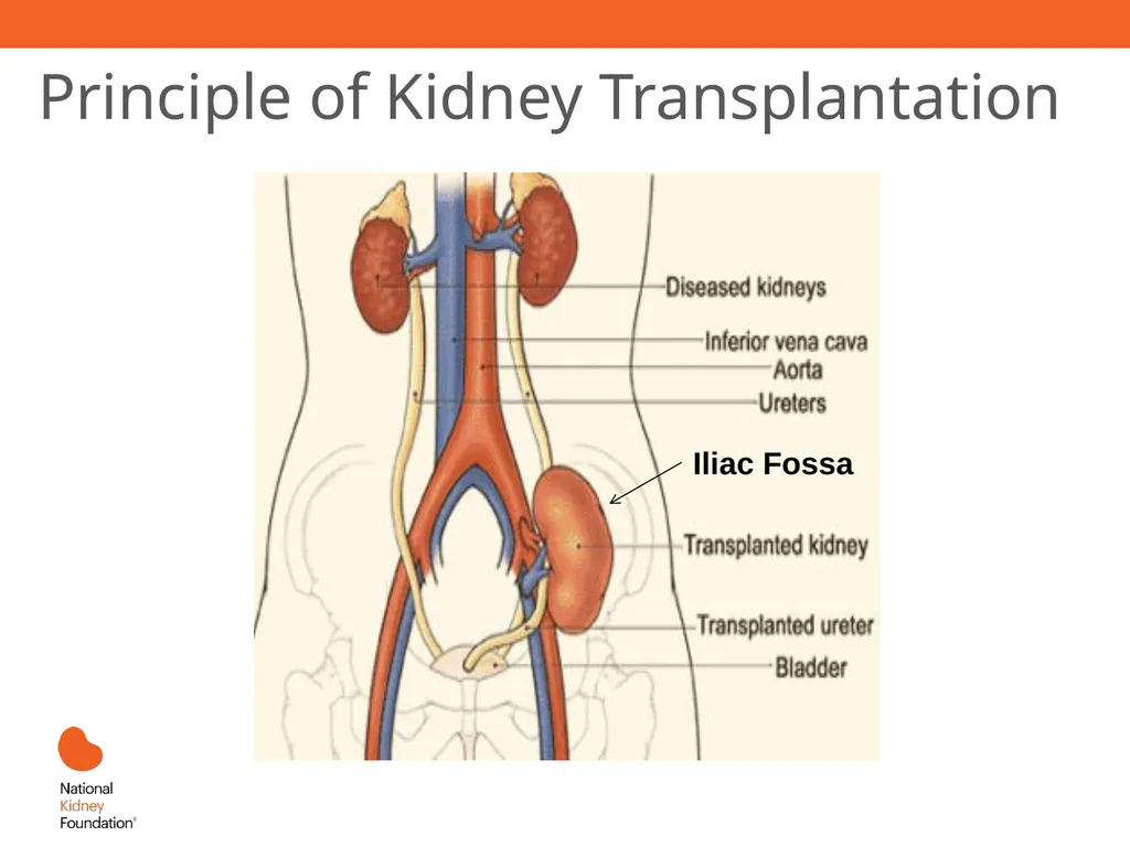 Renal Replacement Therapy: What the PCP Needs to - slide 48 of 64