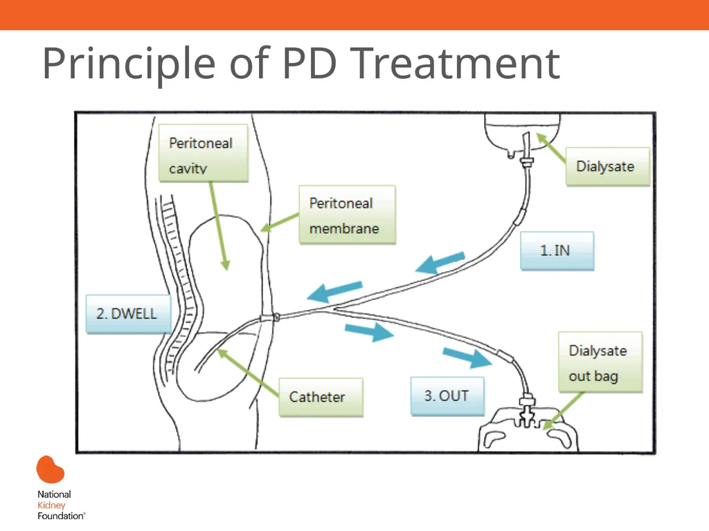 Renal Replacement Therapy: What the PCP Needs to - slide 34 of 64