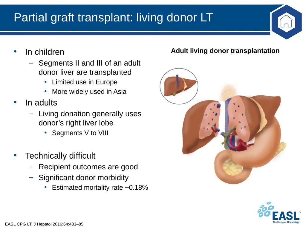 Liver transplantation Clinical Practice Guidelines - slide 39 of 87