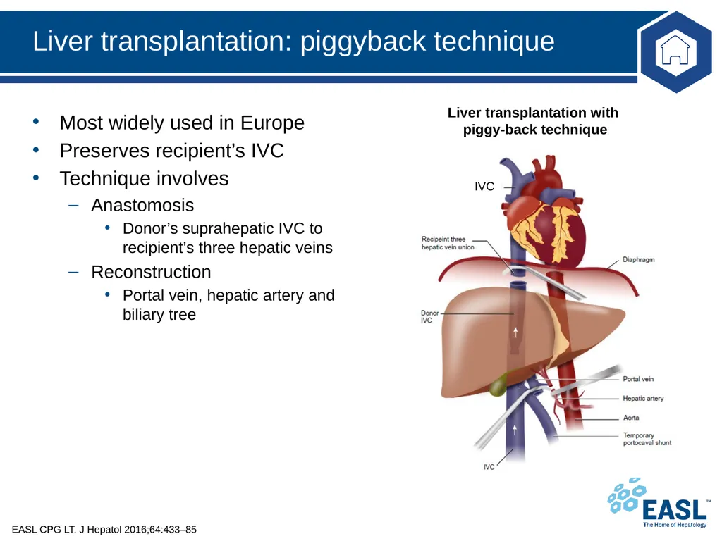 Liver transplantation Clinical Practice Guidelines - slide 36 of 87