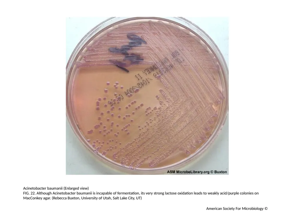 MacConkey Agar Plates Author: Mary E. Allen - slide 23 of 36