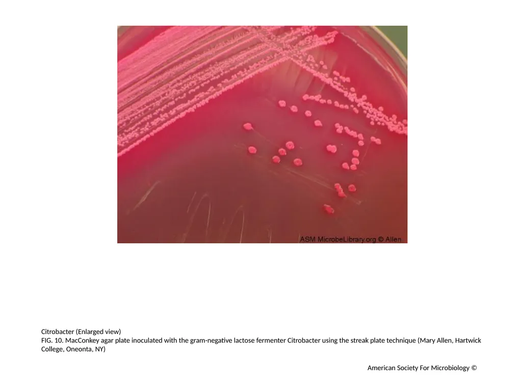 MacConkey Agar Plates Author: Mary E. Allen - slide 11 of 36