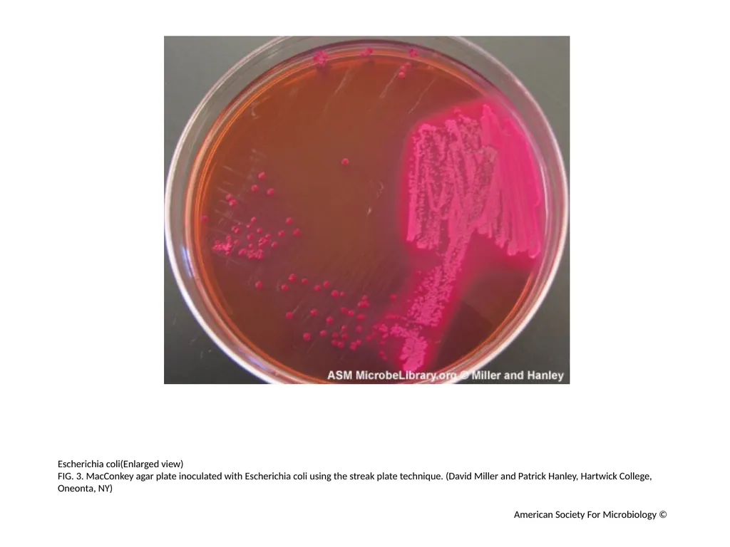 MacConkey Agar Plates Author: Mary E. Allen - slide 4 of 36
