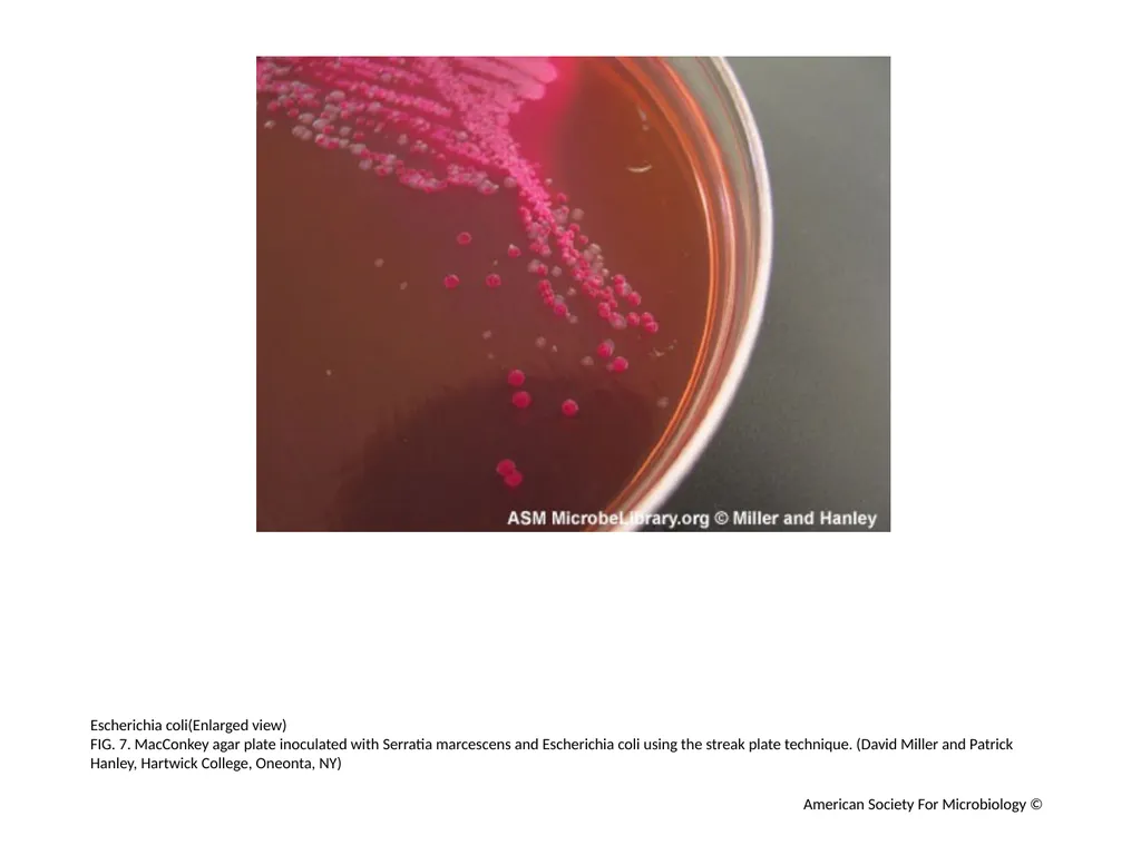 MacConkey Agar Plates Author: Mary E. Allen - slide 8 of 36