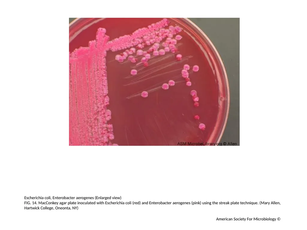 MacConkey Agar Plates Author: Mary E. Allen - slide 15 of 36