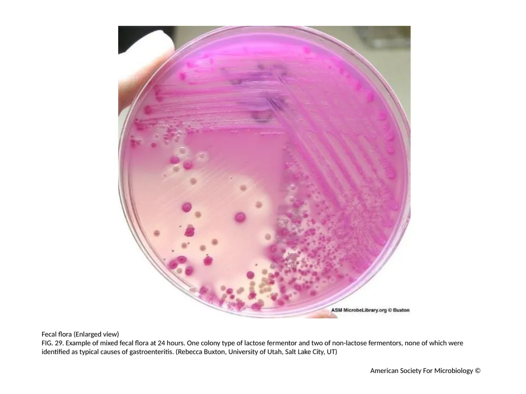 MacConkey Agar Plates Author: Mary E. Allen - slide 30 of 36