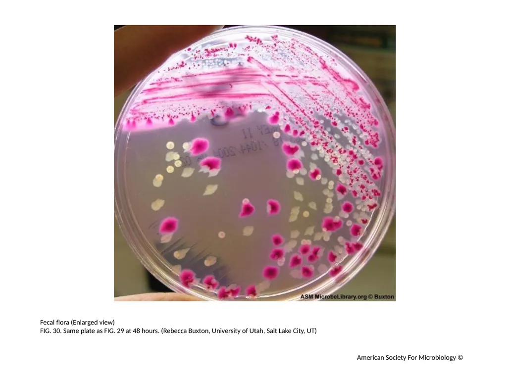 MacConkey Agar Plates Author: Mary E. Allen - slide 31 of 36