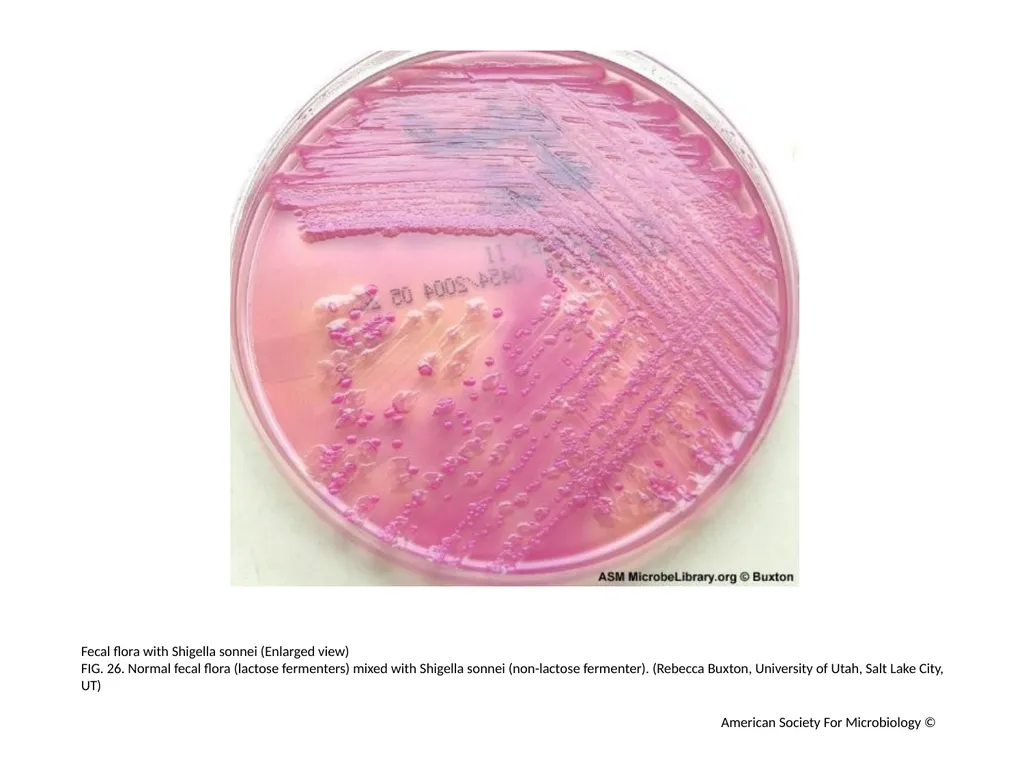 MacConkey Agar Plates Author: Mary E. Allen - slide 27 of 36