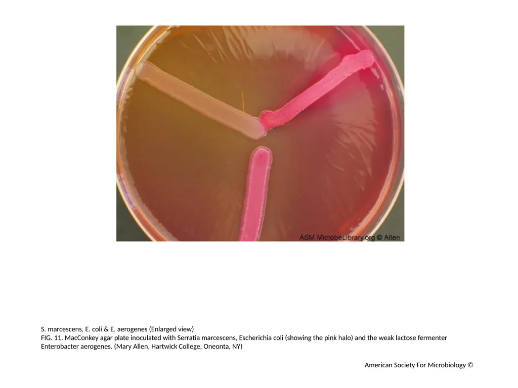 MacConkey Agar Plates Author: Mary E. Allen - slide 12 of 36