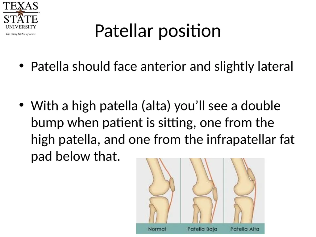 Knee Biomechanics Joint Positions Resting position - slide 13 of 20
