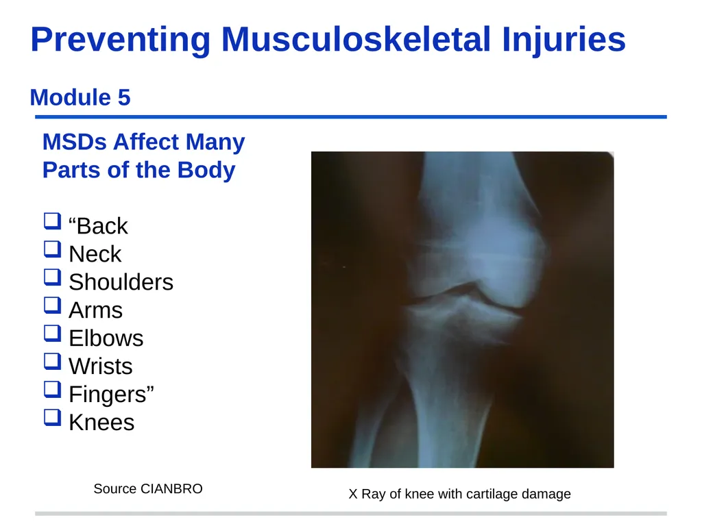 Preventing Musculoskeletal Injuries Module 5 - slide 11 of 48