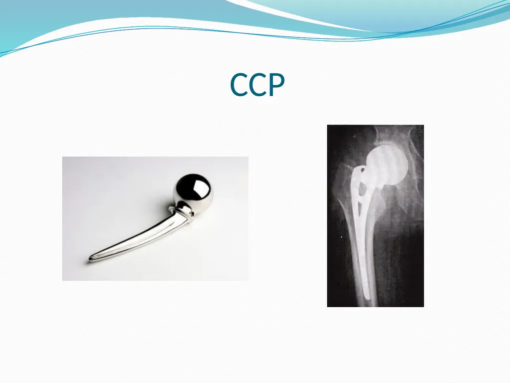 Physical Therapy After Upper Leg Injuries Mgr. - slide 11 of 60