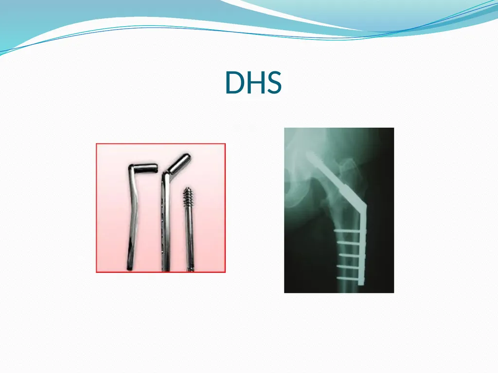 Physical Therapy After Upper Leg Injuries Mgr. - slide 13 of 60