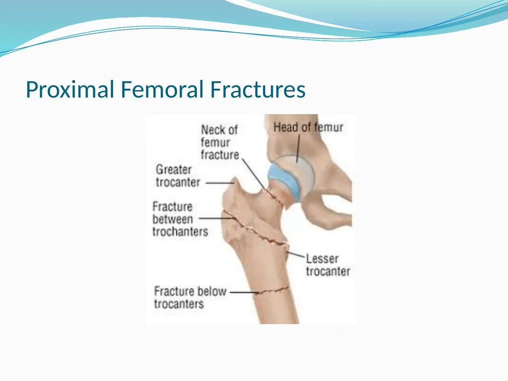 Physical Therapy After Upper Leg Injuries Mgr. - slide 7 of 60