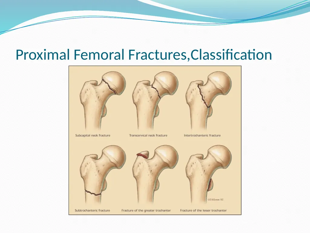Physical Therapy After Upper Leg Injuries Mgr. - slide 8 of 60