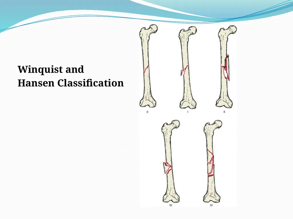 Physical Therapy After Upper Leg Injuries Mgr. - slide 25 of 60
