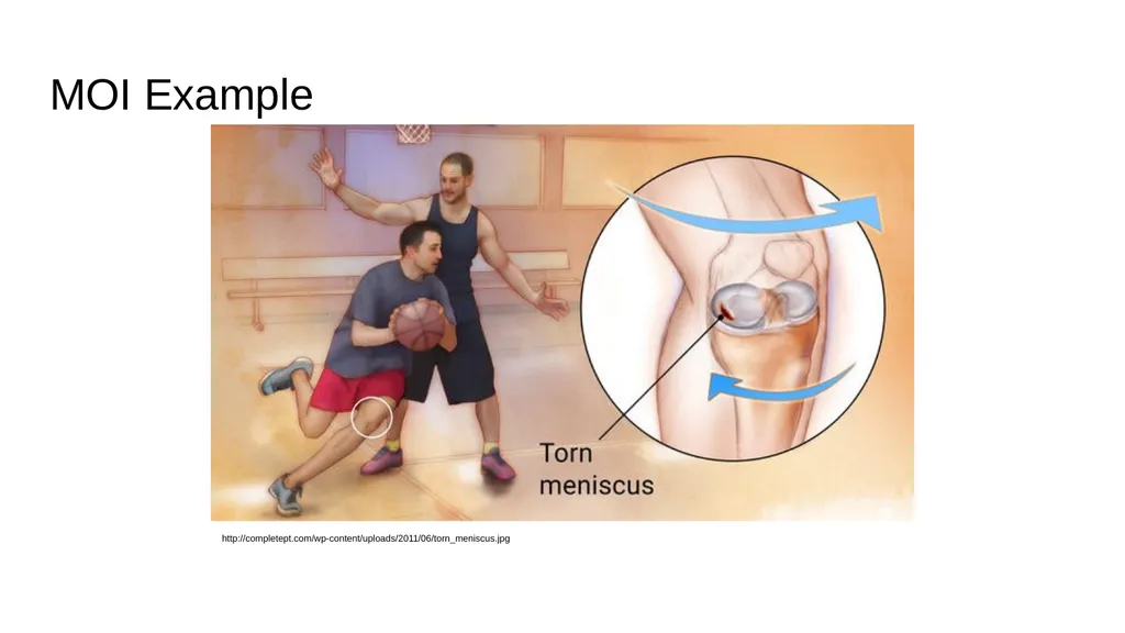 The Meniscus: Injuries, Management and - slide 17 of 74