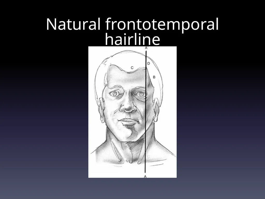 Management of Alopecia Ashley Balaker, MD March - slide 7 of 29