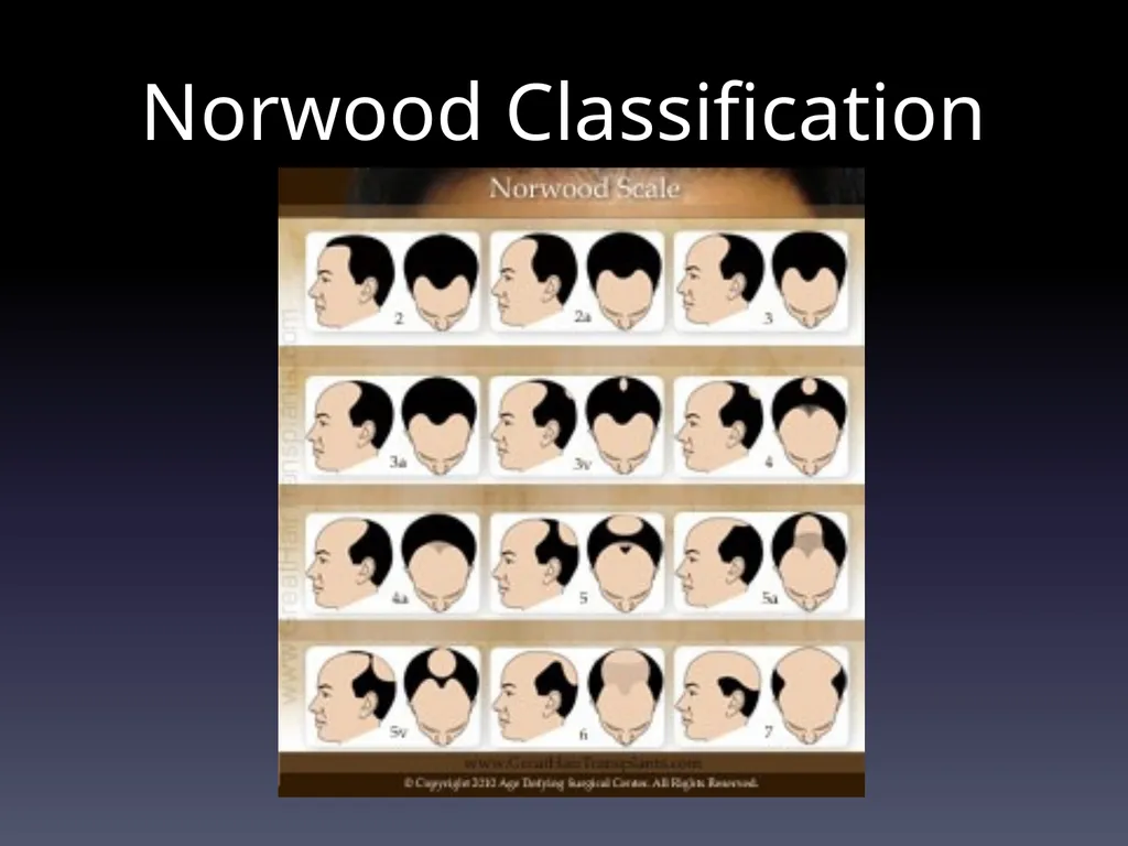 Management of Alopecia Ashley Balaker, MD March - slide 4 of 29