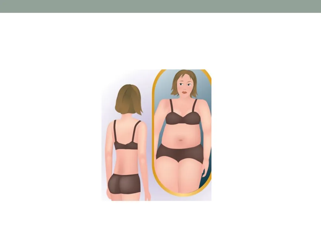 Eating Disorders Kelly Bennett, MD Associate - slide 20 of 32
