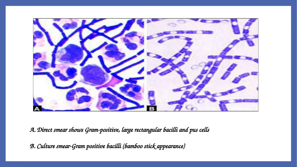 Bacillus anthracis Dr. Priyanka Chaturvedi - slide 15 of 28