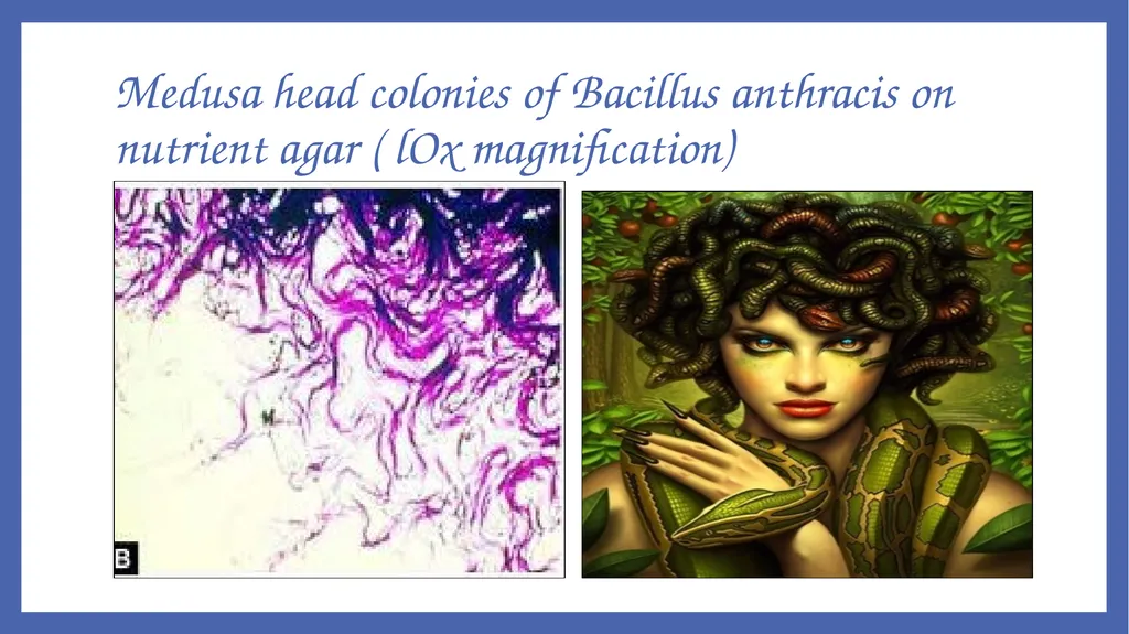 Bacillus anthracis Dr. Priyanka Chaturvedi - slide 19 of 28