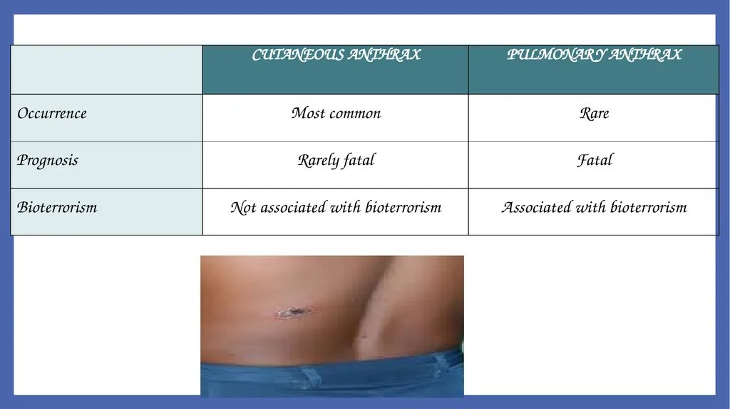 Bacillus anthracis Dr. Priyanka Chaturvedi - slide 10 of 28