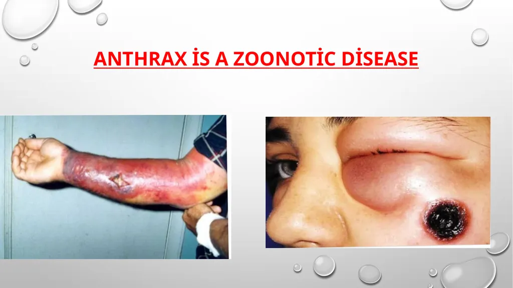ÖRNEK SUNU-7 ANTHRAX What is anthrax? Is anthrax - slide 4 of 12