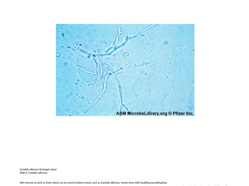 Lactobacillus species (Enlarged view) Slide 1. - slide 6 of 6