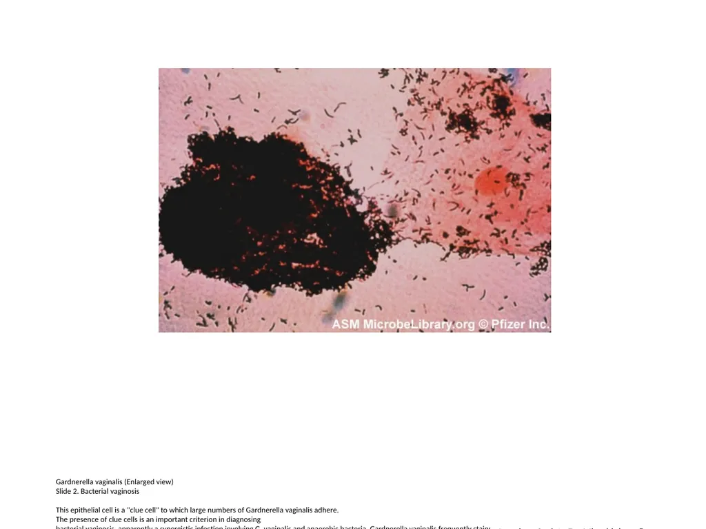 Lactobacillus species (Enlarged view) Slide 1. - slide 2 of 6