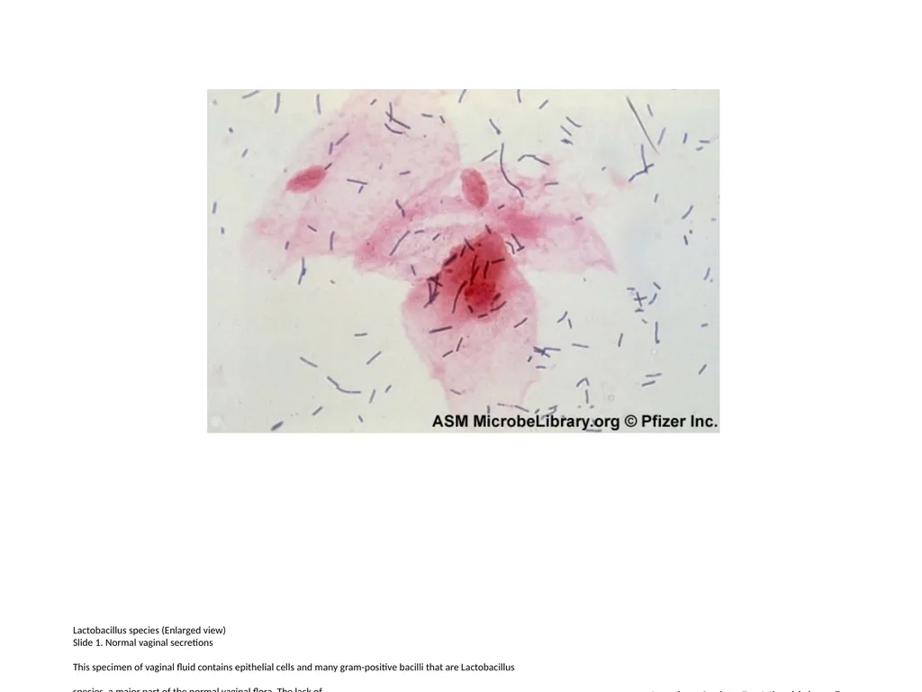 Lactobacillus species (Enlarged view) Slide 1. - slide 1 of 6