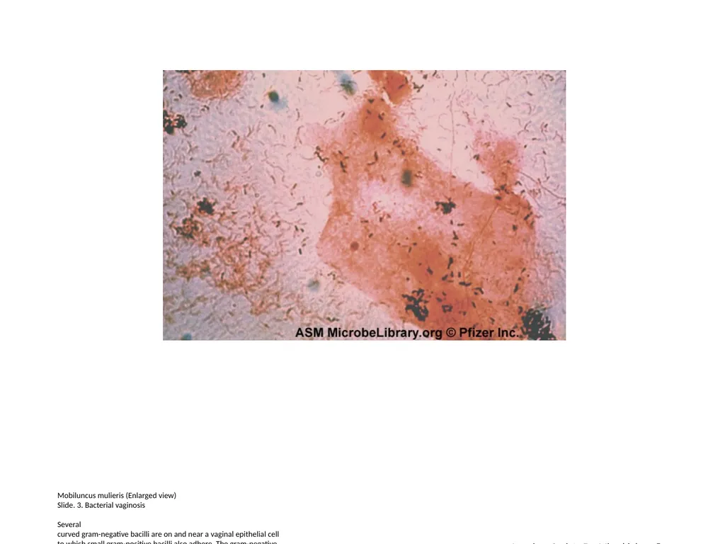 Lactobacillus species (Enlarged view) Slide 1. - slide 3 of 6