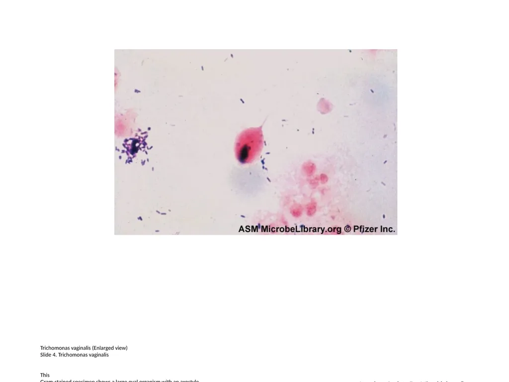 Lactobacillus species (Enlarged view) Slide 1. - slide 4 of 6