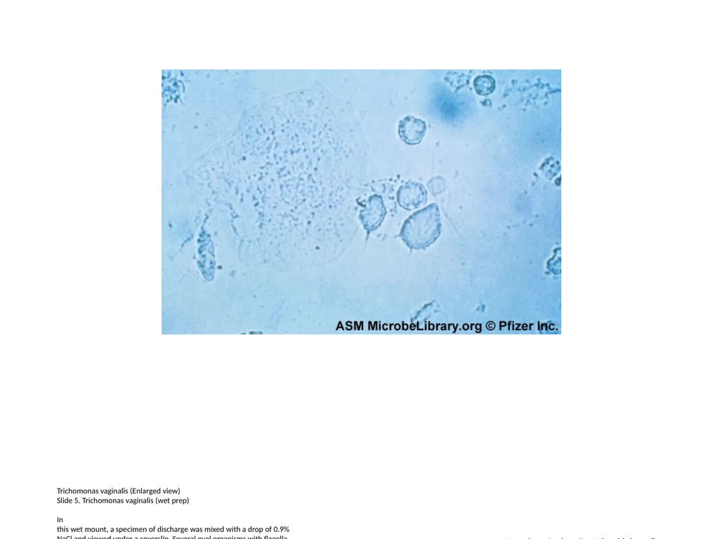 Lactobacillus species (Enlarged view) Slide 1. - slide 5 of 6